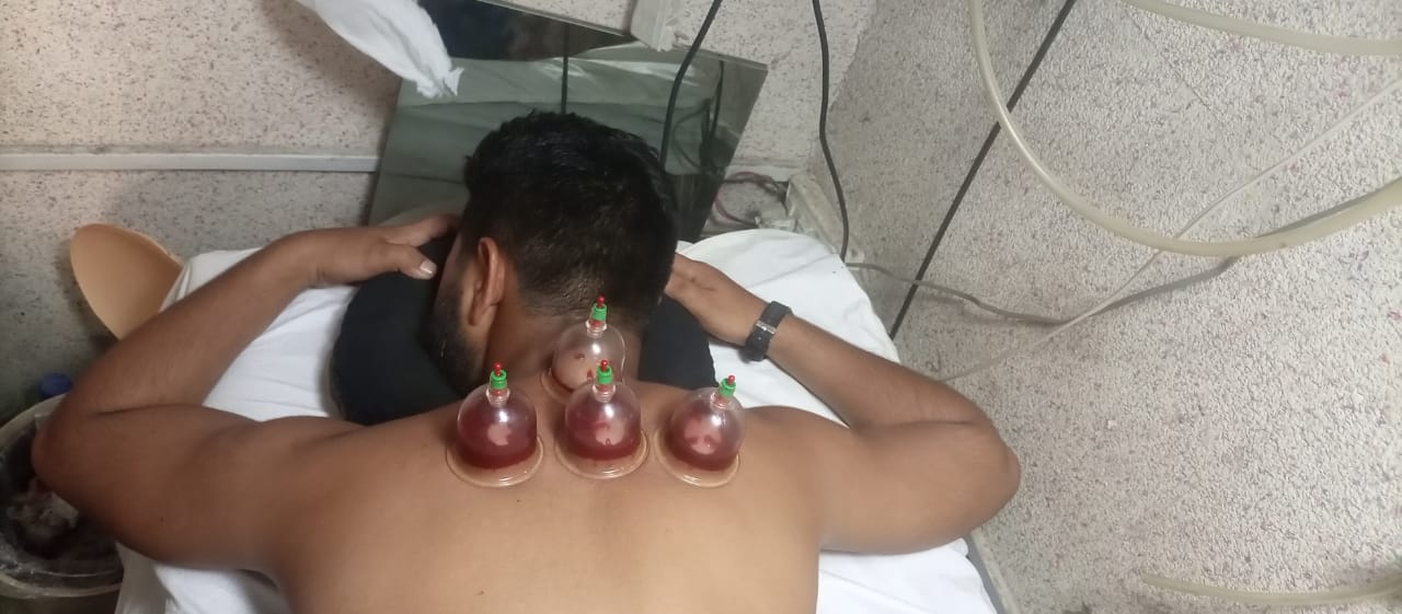 HIJAMA PER POINT