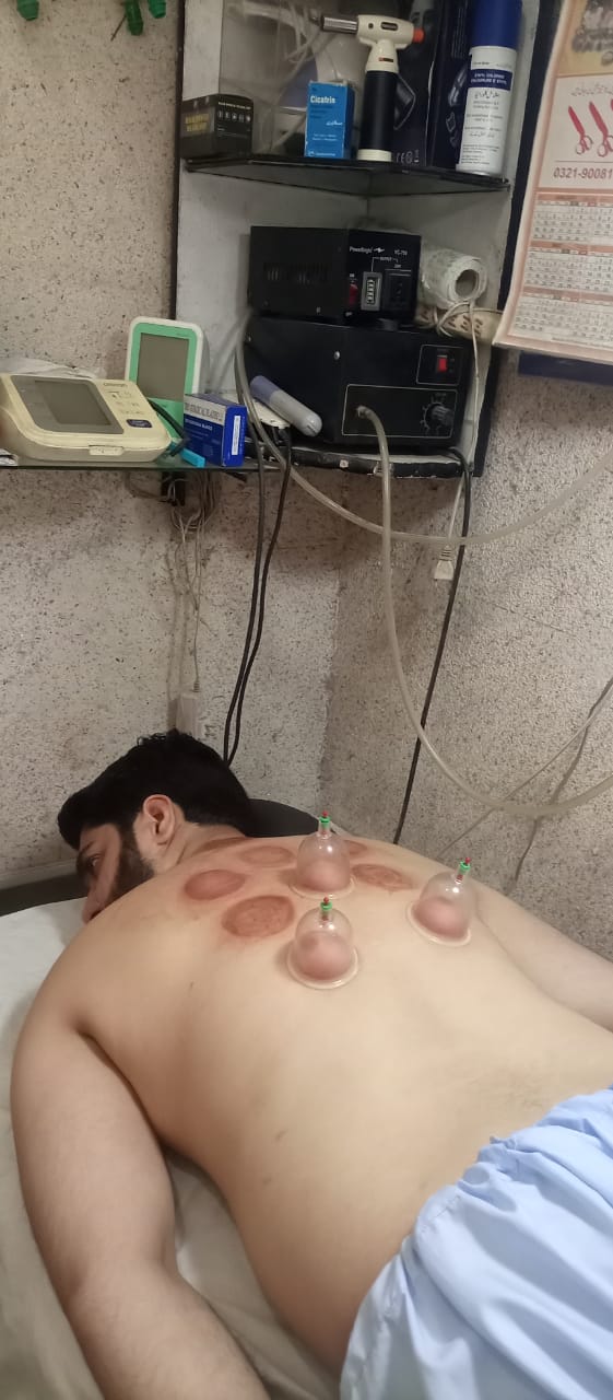 HIJAMA PER POINT